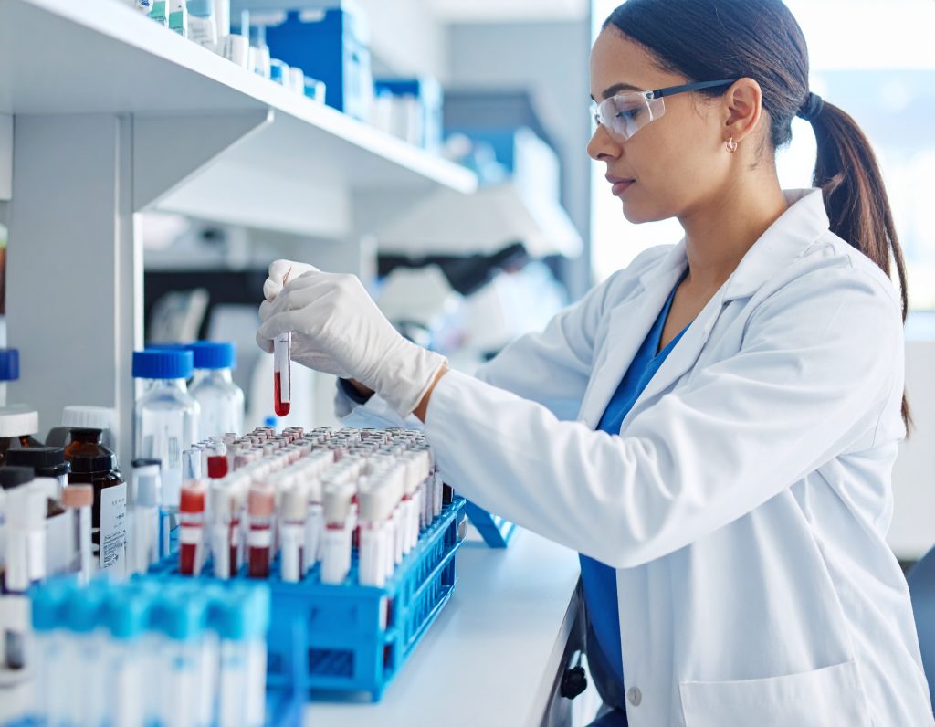 Young woman in a white blouse and gloves in a science lab. She is handling blood sample tubes.